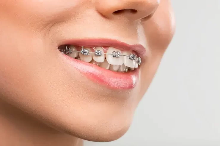 ортодонтия